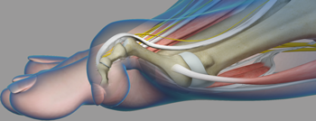 Claw Toe Common Toe Deformity